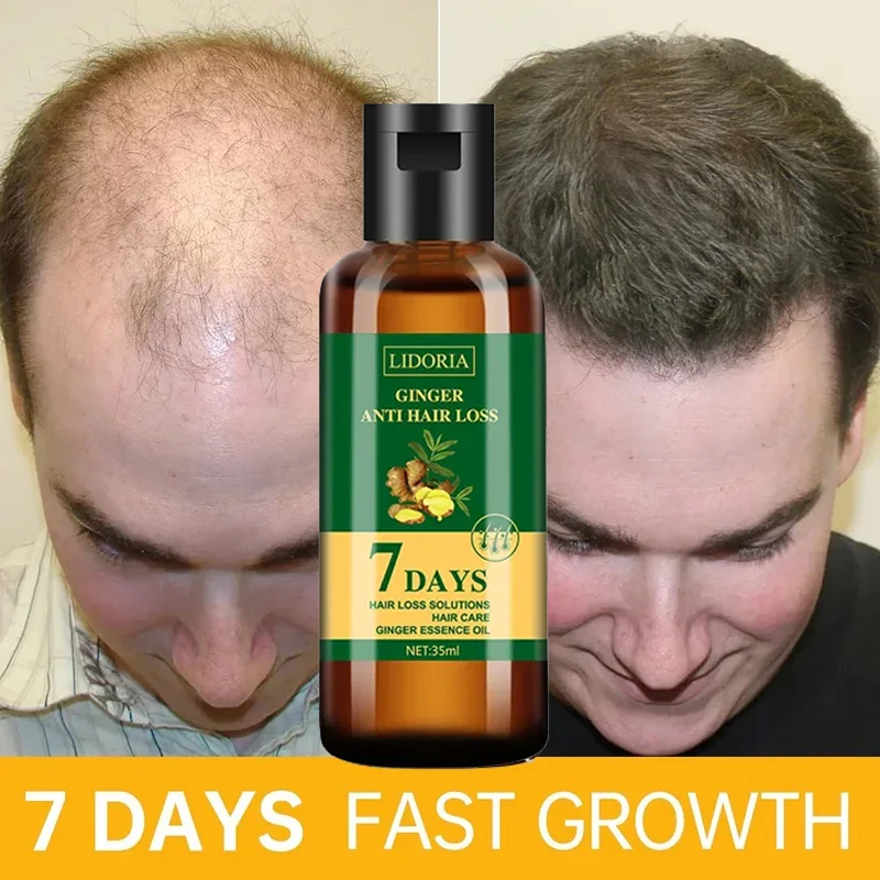 Hair Care Essential Oil Atomizing - Gember Haargroei Etherische Olie Anti-Verlies Haargroei