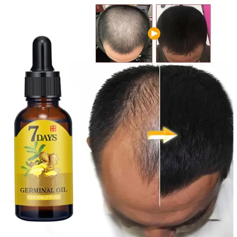 Hair Care Essential Oil Atomizing - Haargroei Gember Snelgroeiend haar Essentiële olie
