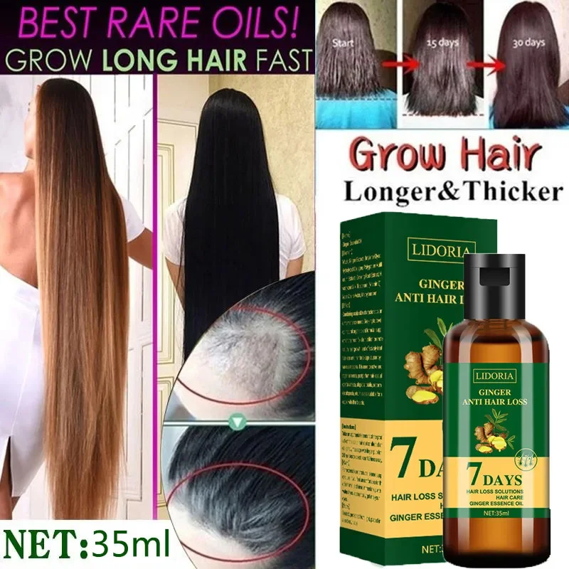 Gember Haargroei Etherische Ol - Hair Care Essential Oil Atomizing recensie en prijs