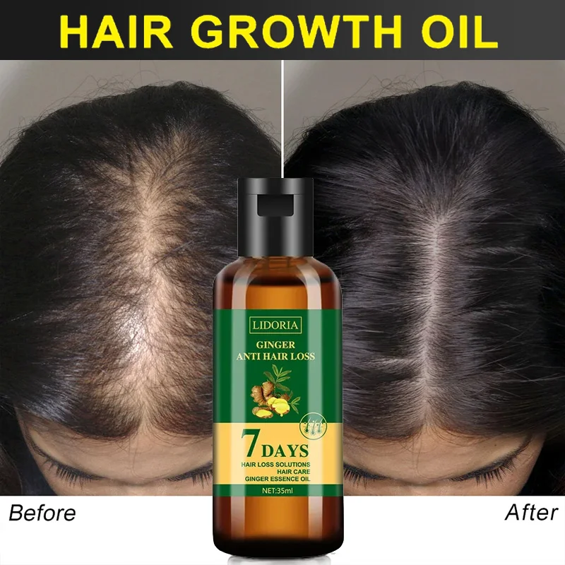 Gember Haargroei Etherische Ol - Hair Care Essential Oil Atomizing recensie en prijs