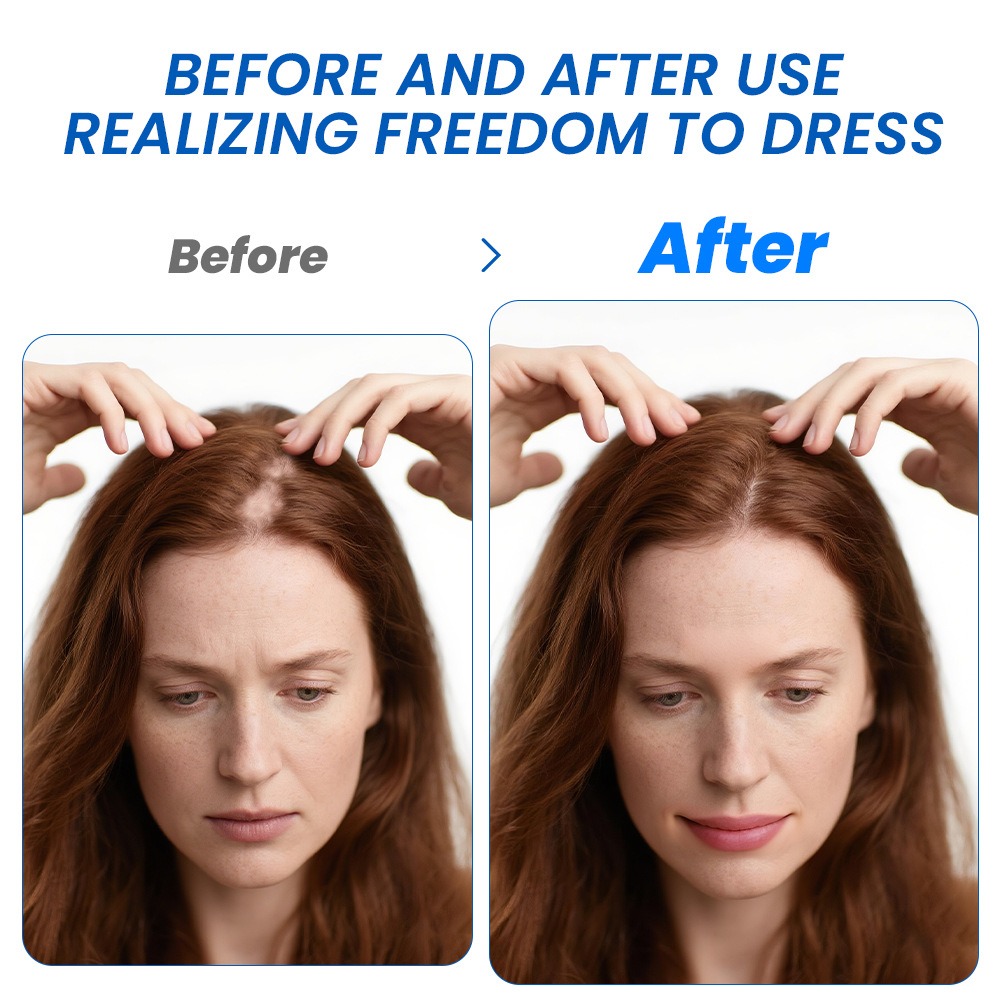 Alopecia Haargroei Spray Sopho - Hair Care Growth recensie en prijs