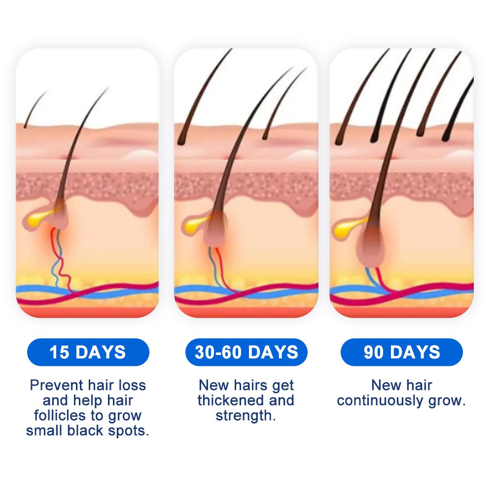Alopecia Haargroei Spray Sopho - Hair Care Growth recensie en prijs