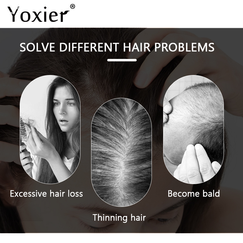 Intensieve Groei Serum Voorkom - Hair Care Growth recensie en prijs