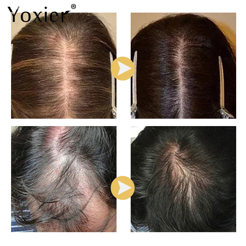 Intensieve Groei Serum Voorkom - Hair Care Growth recensie en prijs