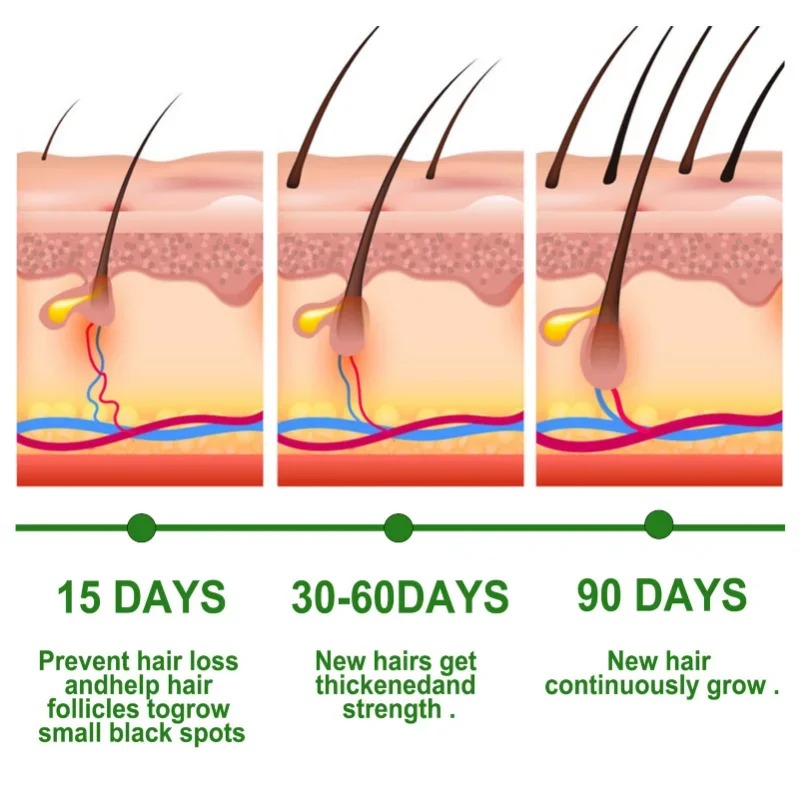 Haargroei Serum Snelgroeiende  - Hair Care Essential Oil Atomizing recensie en prijs