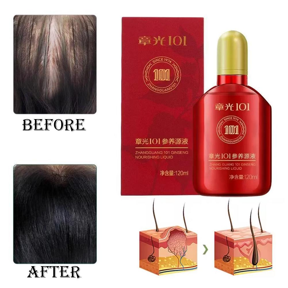 Zhang Guang 101 formule (101P) - Hair Care Normal recensie en prijs