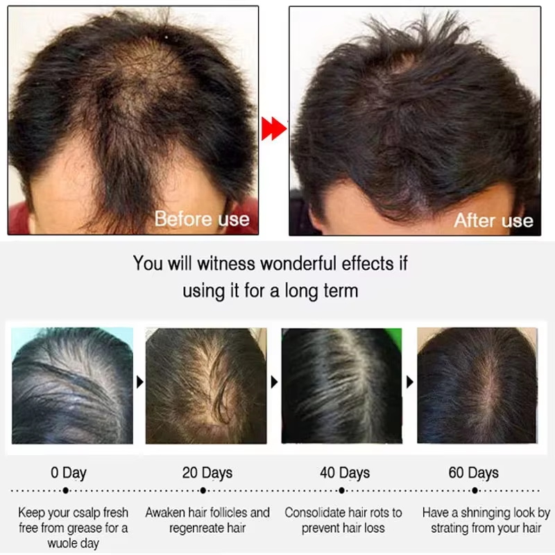 Snelle gember haar groeispray, - Hair Care Growth recensie en prijs