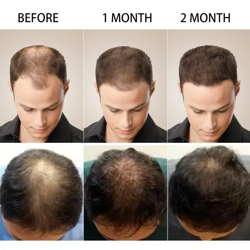 Haargroei Gember Snelgroeiend  - Hair Care Essential Oil Atomizing recensie en prijs