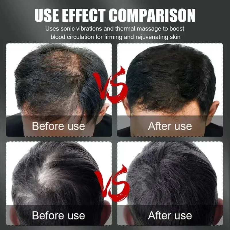 660nm 850nm Rood Licht Infraro - Hair Care Growth recensie en prijs